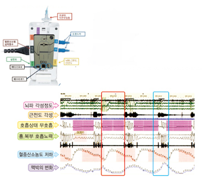 뇌파 각성정도, 근전도 각성, 호흡상태 무호흡, 흉, 복부 호흡노력, 혈중산소농도 저하, 맥박의 변화